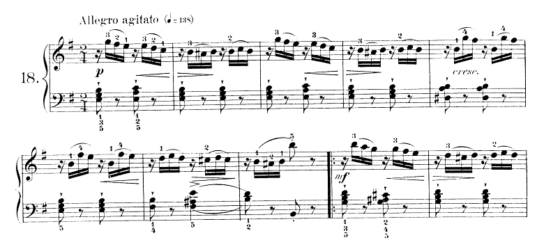 ブルグミュラー「25の練習曲第18番「気がかり」ホ短調 2/4拍子」ピアノ楽譜